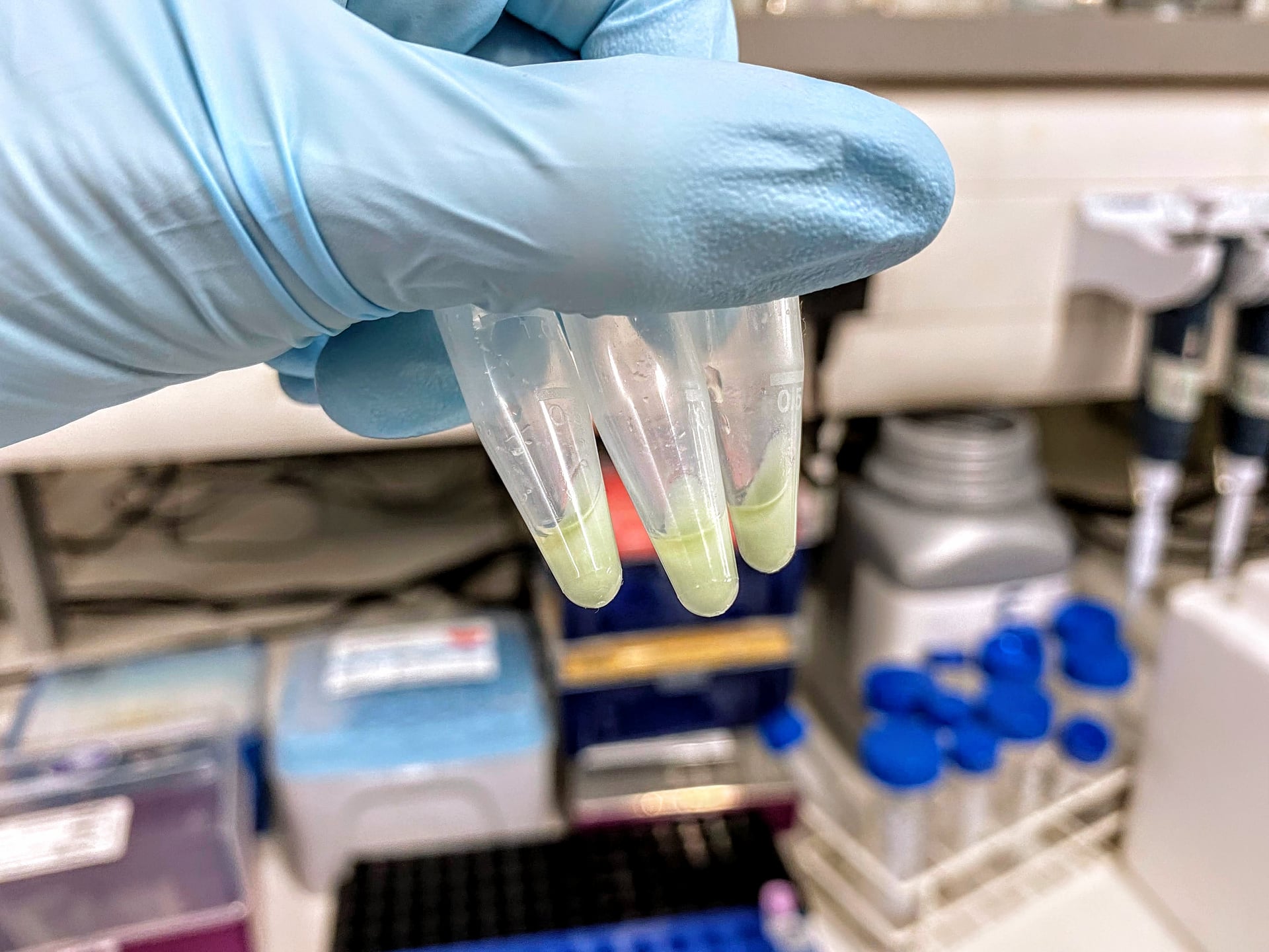 Bacterial culture leftovers.