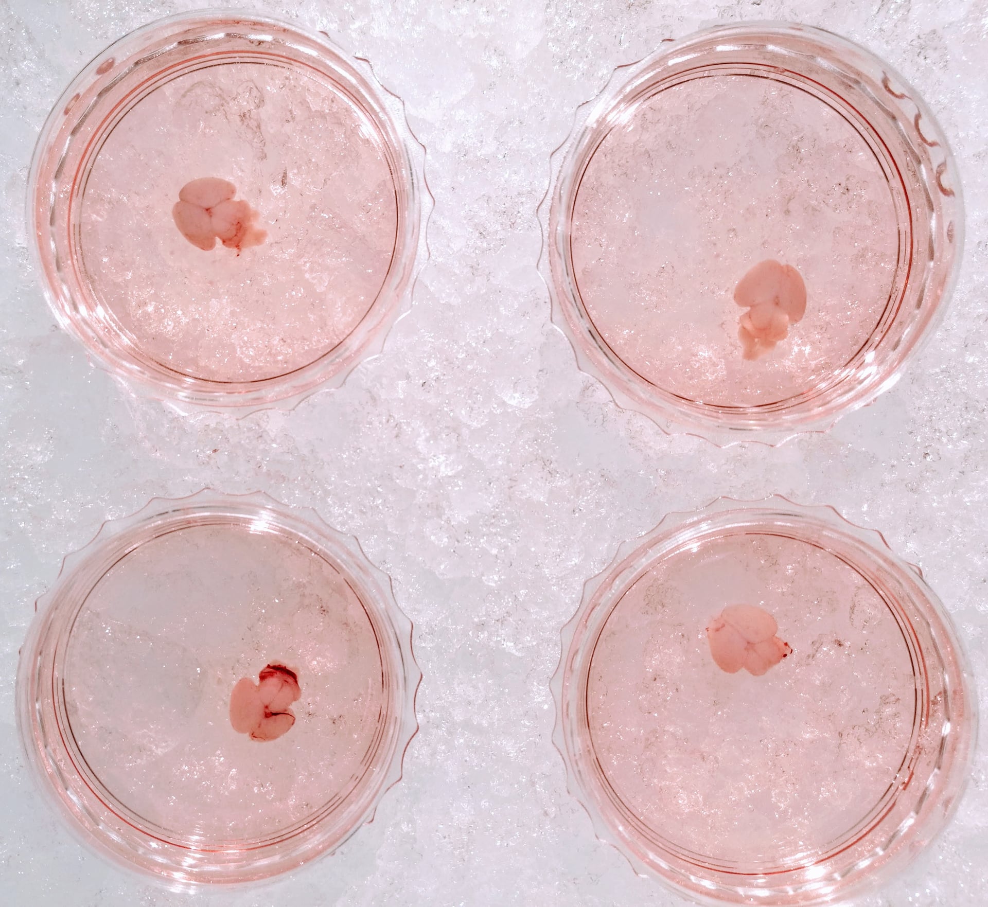 Neonatal brains meticulously dissected for today's riveting experiment.