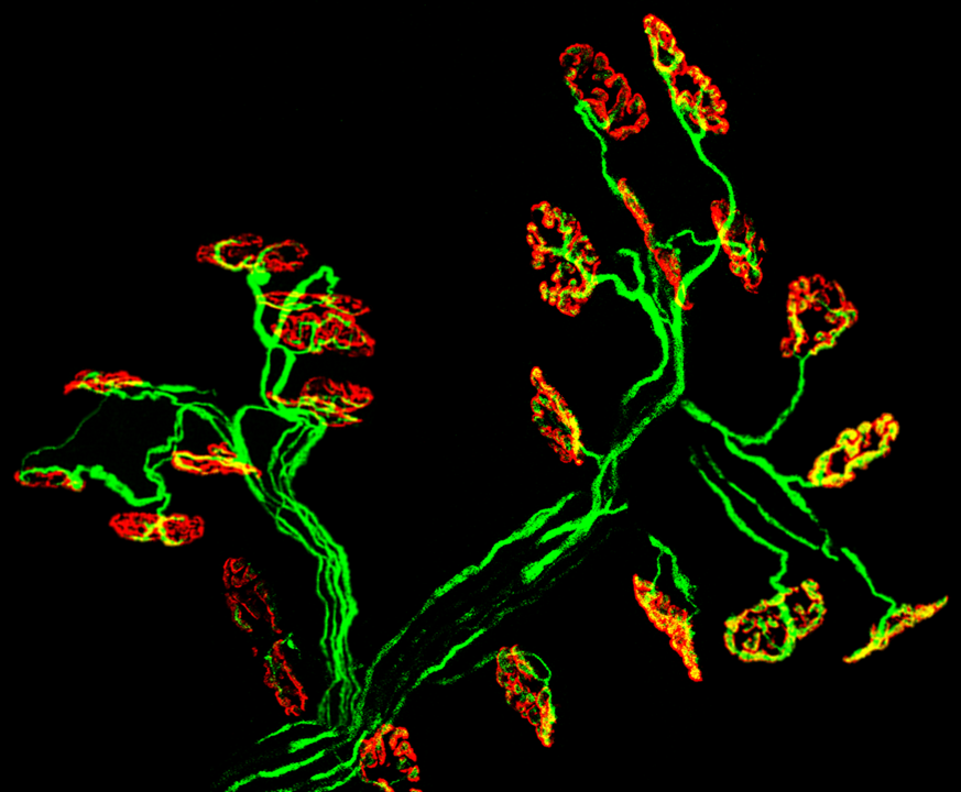 The winning image. These are neurons under the microscope. Filaments of motor neurons (the neurons that instruct muscles to contract or relax) are shown in green, and the connection between neurons and muscles is shown in red.