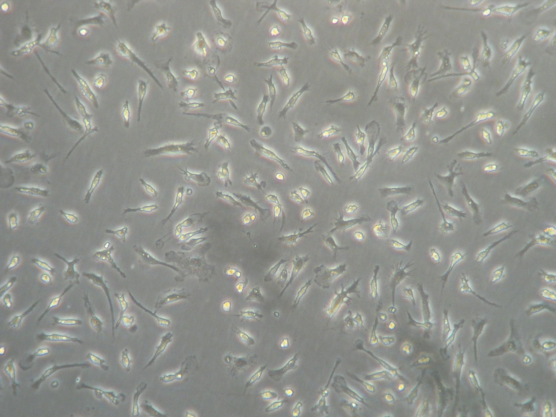 Image from a phase-contrast microscope, showing microglial cells. These cells slowly begin to ramify, and the more time they spend in culture, the more processes they develop.