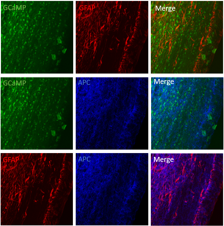Confocal images from a section of the corpus callosum in the adult brain, showing oligodendrocytes in green, myelin sheaths in blue, and astrocytes in red.